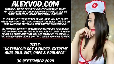 Hotkinkyjo got finger anal handballing prolapse gape belly bulge