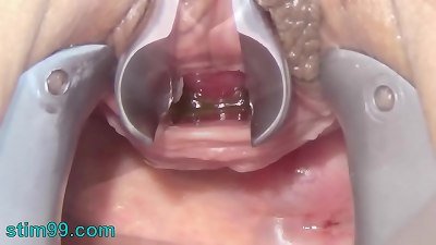 jerk Peehole with Toothbrush and Chain into Urethra